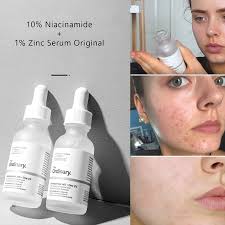 The Ordinary Niacinamide  Serum (50%OFF)